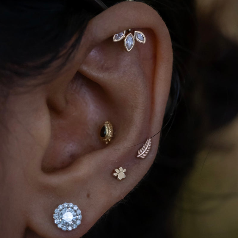 Consultation/Checkup/Downsize